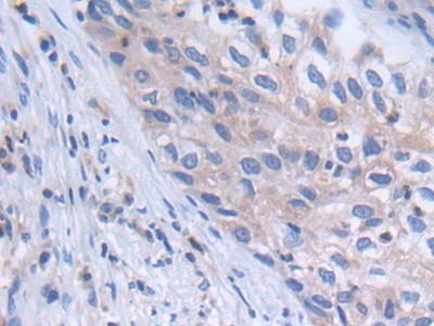 Polyclonal Antibody to Protein Tyrosine Phosphatase, Non Receptor Type 6 (PTPN6)