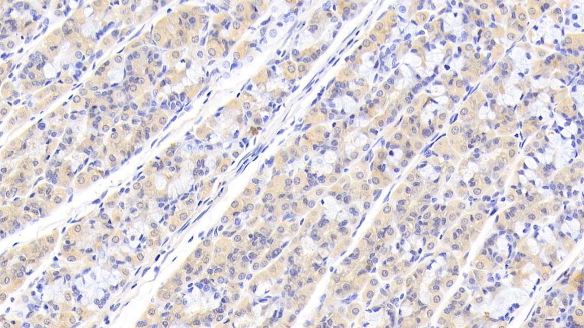 Polyclonal Antibody to Protein Tyrosine Phosphatase, Non Receptor Type 12 (PTPN12)