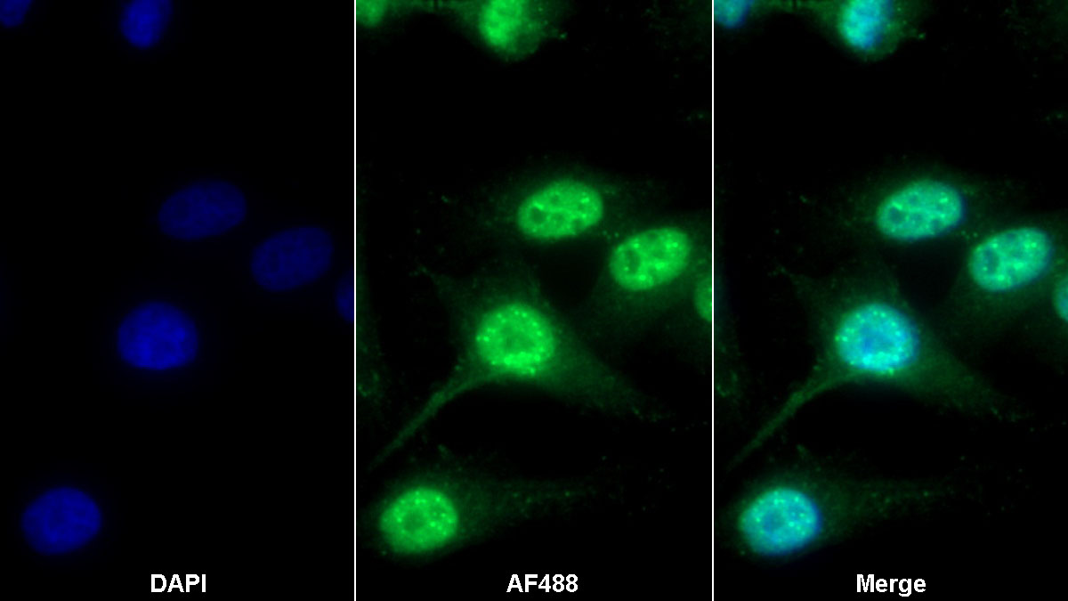 Polyclonal Antibody to Protein Tyrosine Phosphatase, Non Receptor Type 18 (PTPN18)