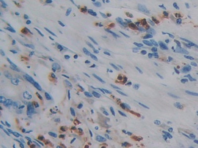 Polyclonal Antibody to Protein Tyrosine Phosphatase Receptor Type Q (PTPRQ)