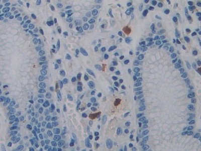 Polyclonal Antibody to Protein Tyrosine Phosphatase Receptor Type Q (PTPRQ)