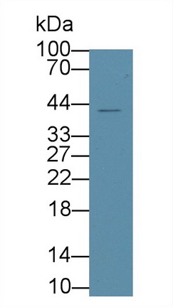 Polyclonal Antibody to Protein Tyrosine Phosphatase Like Protein A (PTPLA)