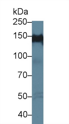 Polyclonal Antibody to Protein Tyrosine Phosphatase F Interacting Protein 1 (PPFIA1)