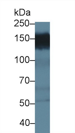 Polyclonal Antibody to Protein Tyrosine Phosphatase F Interacting Protein 1 (PPFIA1)