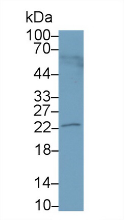 Polyclonal Antibody to Protein Tyrosine Phosphatase Type IVA 3 (PTP4A3)