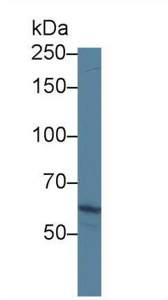 Polyclonal Antibody to ATP Binding Cassette Transporter A3 (ABCA3)