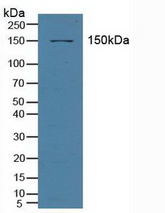 Polyclonal Antibody to ATP Binding Cassette Transporter C3 (ABCC3)