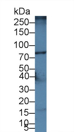 Polyclonal Antibody to ATP Binding Cassette Transporter B5 (ABCB5)