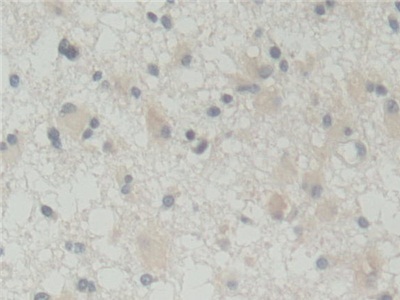 Polyclonal Antibody to ATP Binding Cassette Transporter B5 (ABCB5)