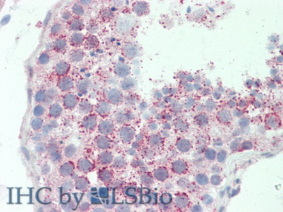 Polyclonal Antibody to ATP Binding Cassette Transporter B6 (ABCB6)