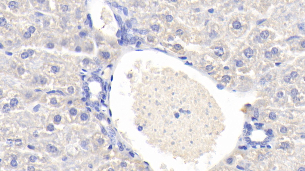 Polyclonal Antibody to ATP Binding Cassette Transporter B7 (ABCB7)