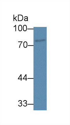 Polyclonal Antibody to ATP Binding Cassette Transporter B8 (ABCB8)