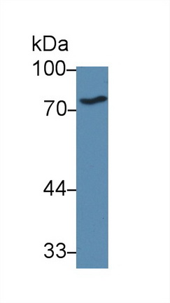 Polyclonal Antibody to ATP Binding Cassette Transporter B8 (ABCB8)