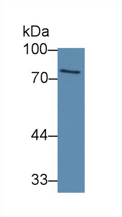 Polyclonal Antibody to ATP Binding Cassette Transporter B8 (ABCB8)