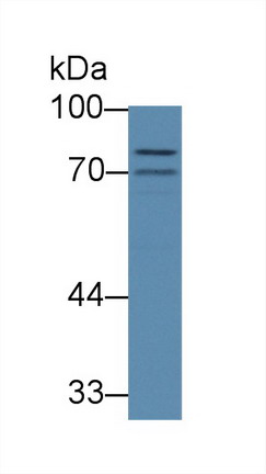 Polyclonal Antibody to ATP Binding Cassette Transporter B8 (ABCB8)