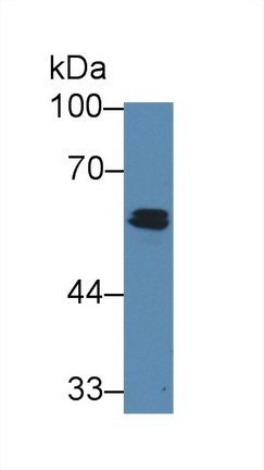 Polyclonal Antibody to ATP Binding Cassette Transporter B8 (ABCB8)