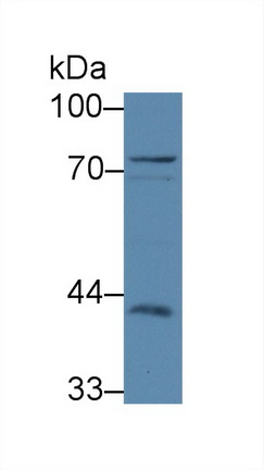 Polyclonal Antibody to ATP Binding Cassette Transporter B8 (ABCB8)