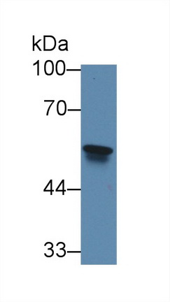 Polyclonal Antibody to ATP Binding Cassette Transporter B8 (ABCB8)