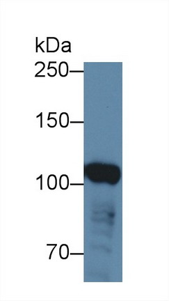 Polyclonal Antibody to ATP Binding Cassette Transporter F1 (ABCF1)