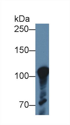 Polyclonal Antibody to ATP Binding Cassette Transporter F1 (ABCF1)