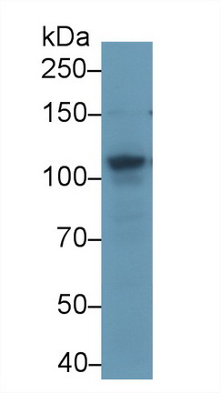 Polyclonal Antibody to ATP Binding Cassette Transporter F1 (ABCF1)