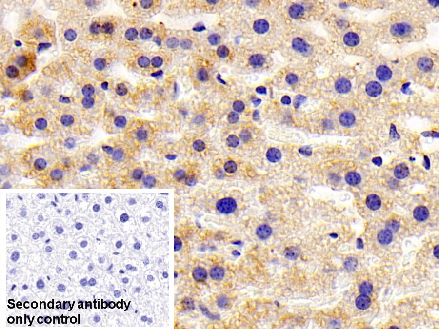 Polyclonal Antibody to ATP Binding Cassette Transporter F1 (ABCF1)