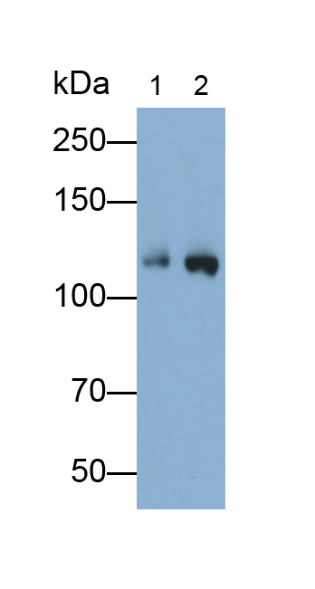 Polyclonal Antibody to ATP Binding Cassette Transporter F1 (ABCF1)