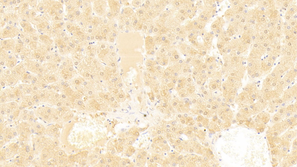 Polyclonal Antibody to ATP Binding Cassette Transporter A8 (ABCA8)