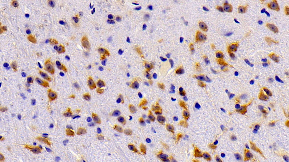 Polyclonal Antibody to ATP Binding Cassette Transporter A8 (ABCA8)