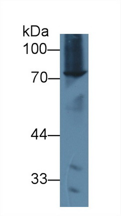 Polyclonal Antibody to ATP Binding Cassette Transporter D2 (ABCD2)