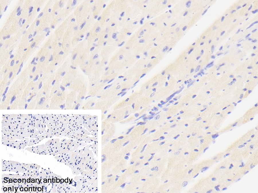 Polyclonal Antibody to ATP Binding Cassette Transporter D2 (ABCD2)