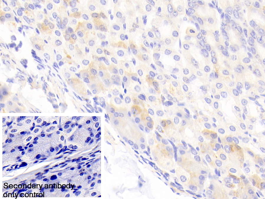 Polyclonal Antibody to ATP Binding Cassette Transporter D2 (ABCD2)