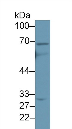 Polyclonal Antibody to ATP Binding Cassette Transporter D4 (ABCD4)