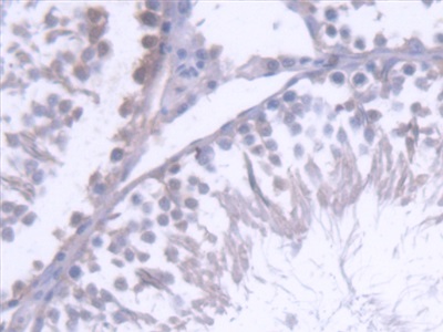 Polyclonal Antibody to ATP Binding Cassette Transporter G8 (ABCG8)