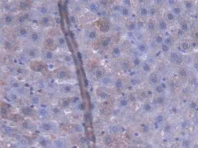 Polyclonal Antibody to ATP Binding Cassette Transporter G8 (ABCG8)