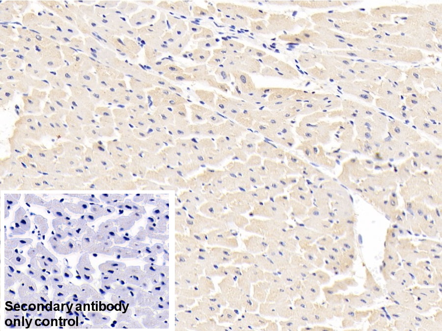 Polyclonal Antibody to Acetyl Coenzyme A Acyltransferase 2 (ACAA2)