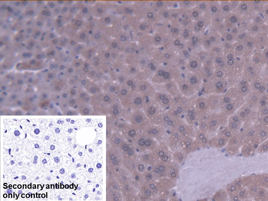 Polyclonal Antibody to Acetyl Coenzyme A Acyltransferase 2 (ACAA2)