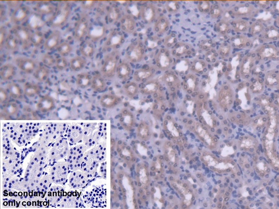 Polyclonal Antibody to Acetyl Coenzyme A Acyltransferase 2 (ACAA2)