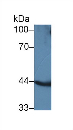 Polyclonal Antibody to Acyl Coenzyme A Dehydrogenase, Long Chain (ACADL)