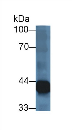 Polyclonal Antibody to Acyl Coenzyme A Dehydrogenase, Long Chain (ACADL)