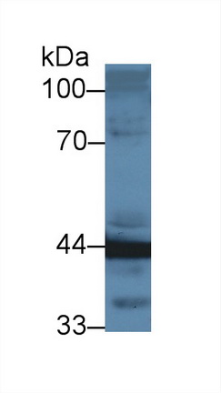 Polyclonal Antibody to Acyl Coenzyme A Dehydrogenase, Long Chain (ACADL)