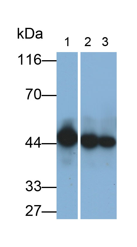 Polyclonal Antibody to Acyl Coenzyme A Dehydrogenase, Long Chain (ACADL)