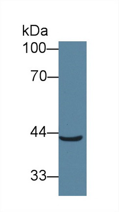 Polyclonal Antibody to Acyl Coenzyme A Dehydrogenase, C4-To-C12 Straight Chain (ACADM)