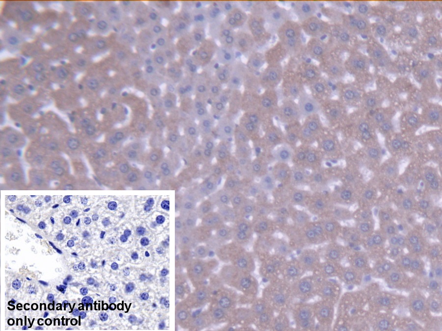 Polyclonal Antibody to Acyl Coenzyme A Dehydrogenase, C4-To-C12 Straight Chain (ACADM)