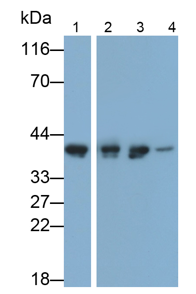 Polyclonal Antibody to Acyl Coenzyme A Dehydrogenase, C4-To-C12 Straight Chain (ACADM)