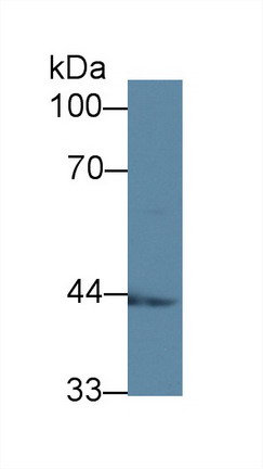 Polyclonal Antibody to Acyl Coenzyme A Dehydrogenase, C2-To-C3 Short Chain (ACADS)