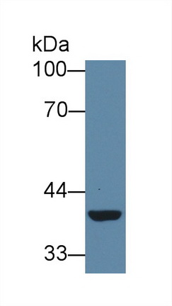 Polyclonal Antibody to Acyl Coenzyme A Dehydrogenase, C2-To-C3 Short Chain (ACADS)