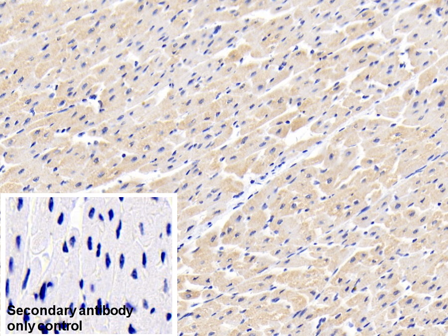 Polyclonal Antibody to Acyl Coenzyme A Dehydrogenase, C2-To-C3 Short Chain (ACADS)