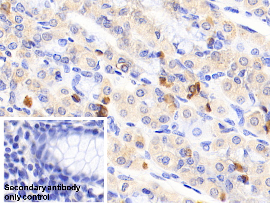 Polyclonal Antibody to Acyl Coenzyme A Dehydrogenase, C2-To-C3 Short Chain (ACADS)