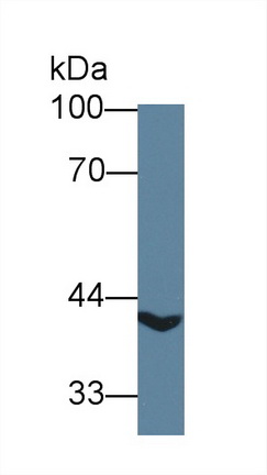 Polyclonal Antibody to Acyl Coenzyme A Dehydrogenase, C2-To-C3 Short Chain (ACADS)